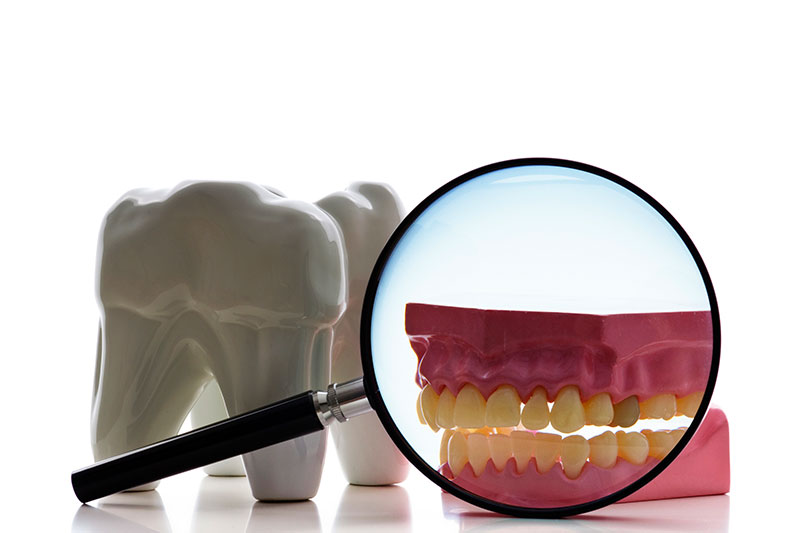 Root Canal in Walnut Creek